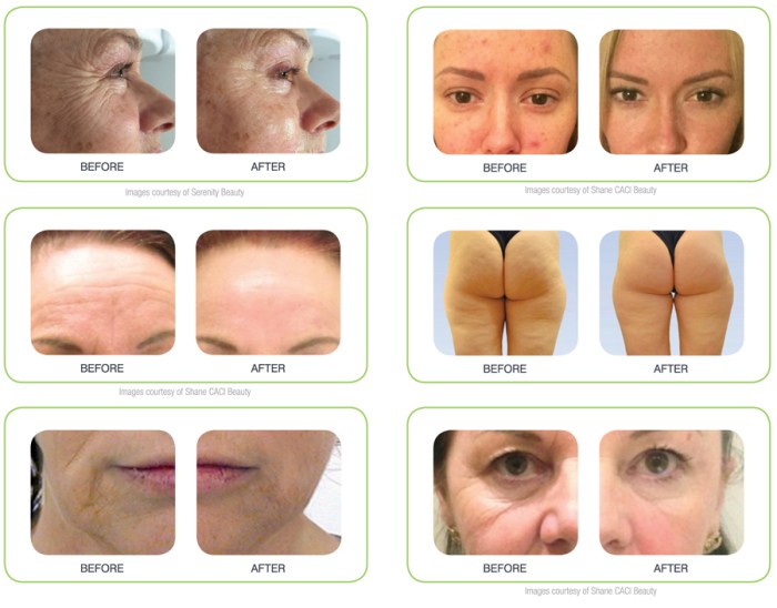 caci-results